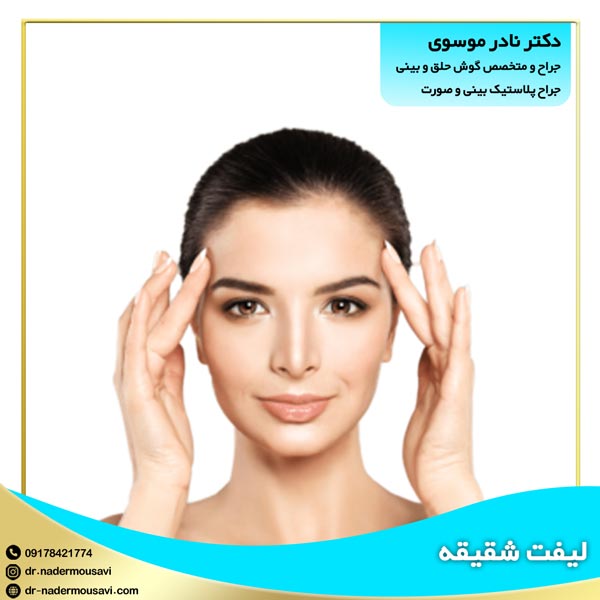 لیفت شقیقه