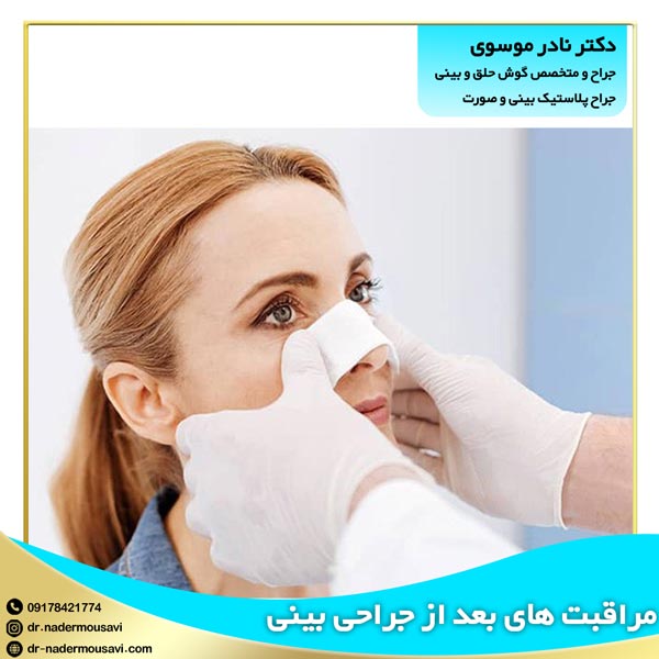 مراقبت های بعد از جراحی بینی - دکتر نادر موسوی