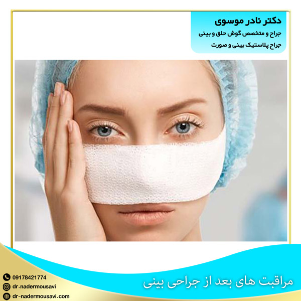 مراقبت های بعد از جراحی بینی - دکتر نادر موسوی