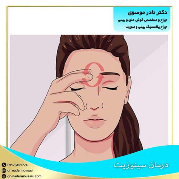 درمان سینوزیت - دکتر نادر موسوی