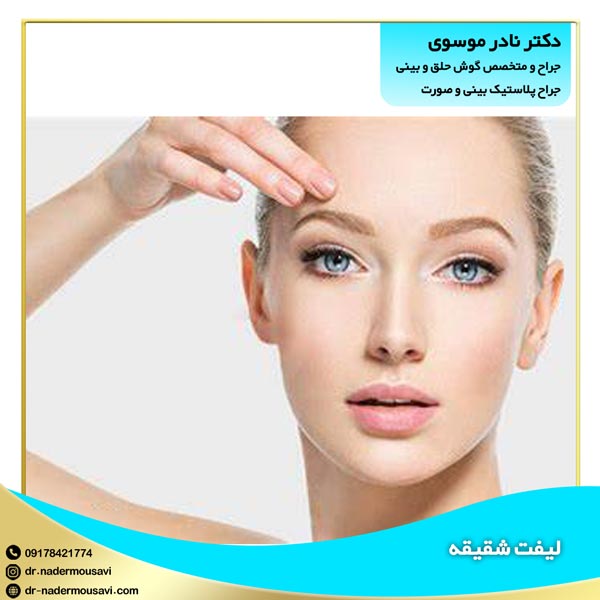 لیفت شقیقه در شیراز 