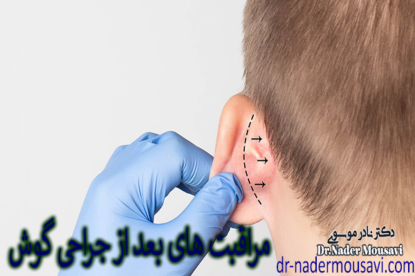 عکس مراقبت های بعد از جراحی گوش - دکتر نادر موسوی