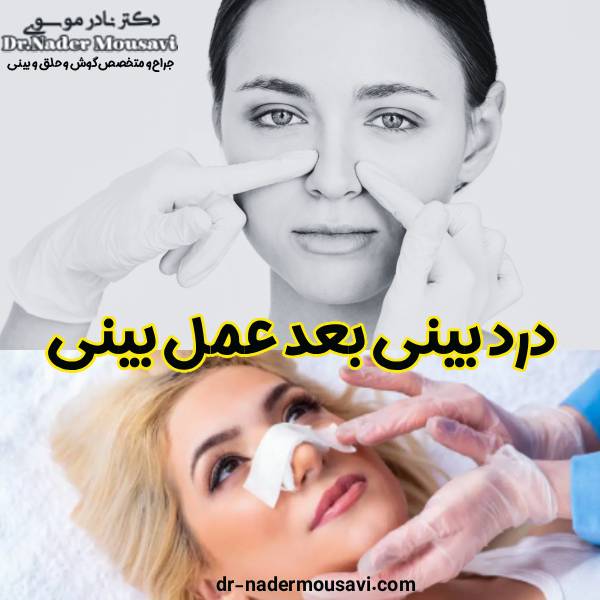 درد بینی بعد عمل - دکتر نادر موسوی