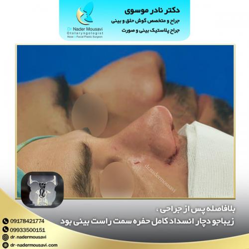 جراحی-زیبایی-بینی-128