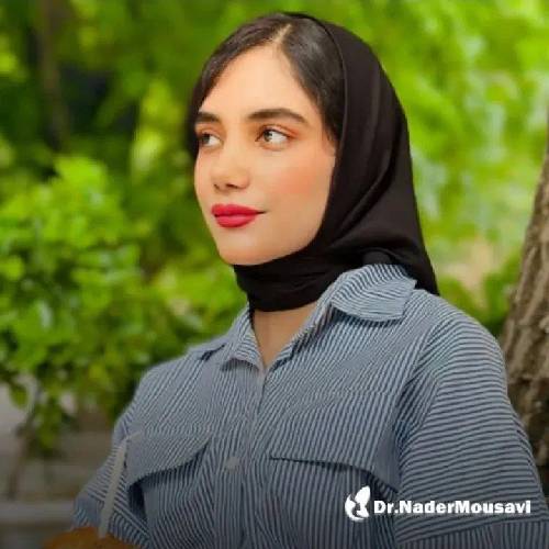 جراحی-زیبایی-بینی-225