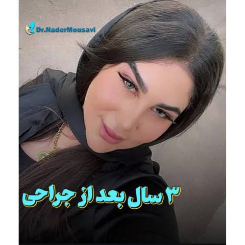 جراحی-زیبایی-بینی-224