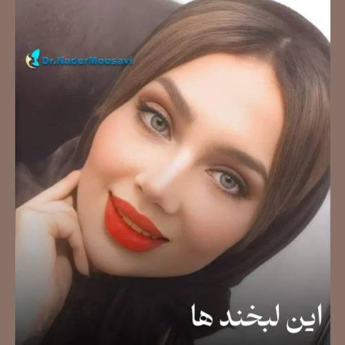 جراحی-زیبایی-بینی-227