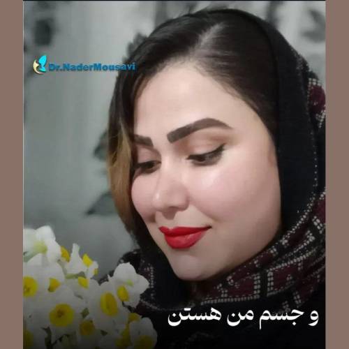 جراحی-زیبایی-بینی-230
